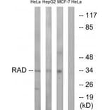 Western blot - RAD Antibody from Signalway Antibody (34723) - Antibodies.com