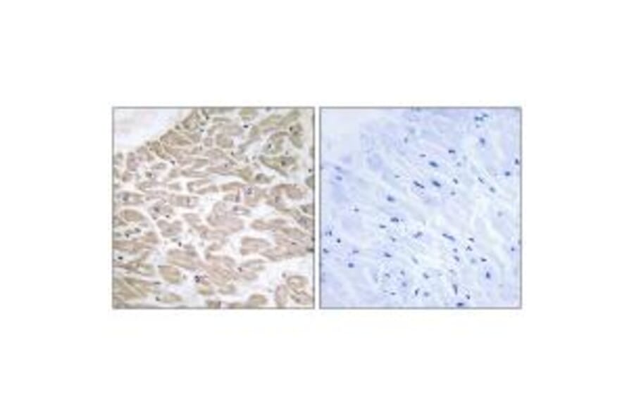 Immunohistochemistry - RAD Antibody from Signalway Antibody (34723) - Antibodies.com