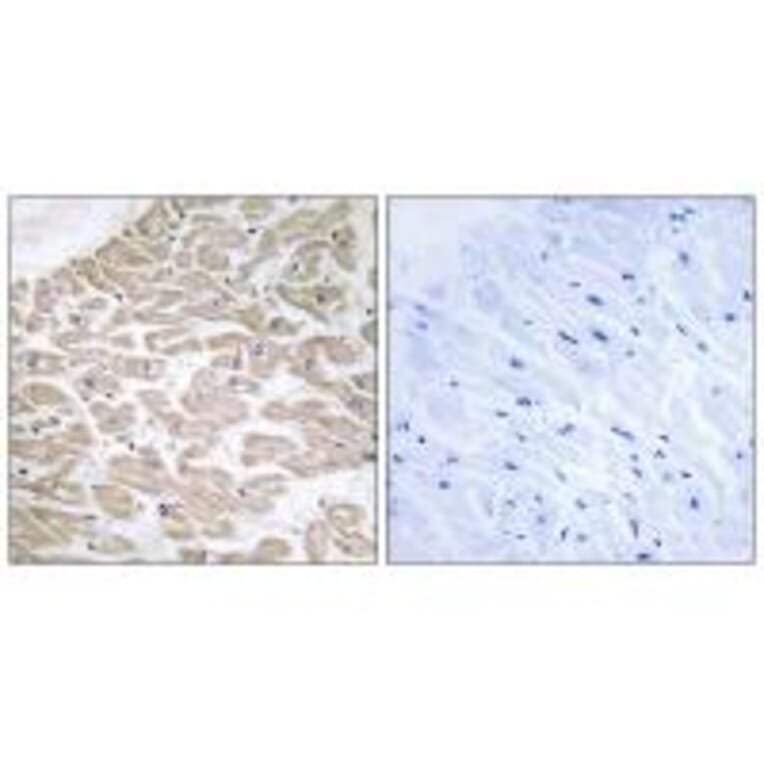 Immunohistochemistry - RAD Antibody from Signalway Antibody (34723) - Antibodies.com