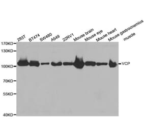Western blot - VCP antibody from Signalway Antibody (38469) - Antibodies.com