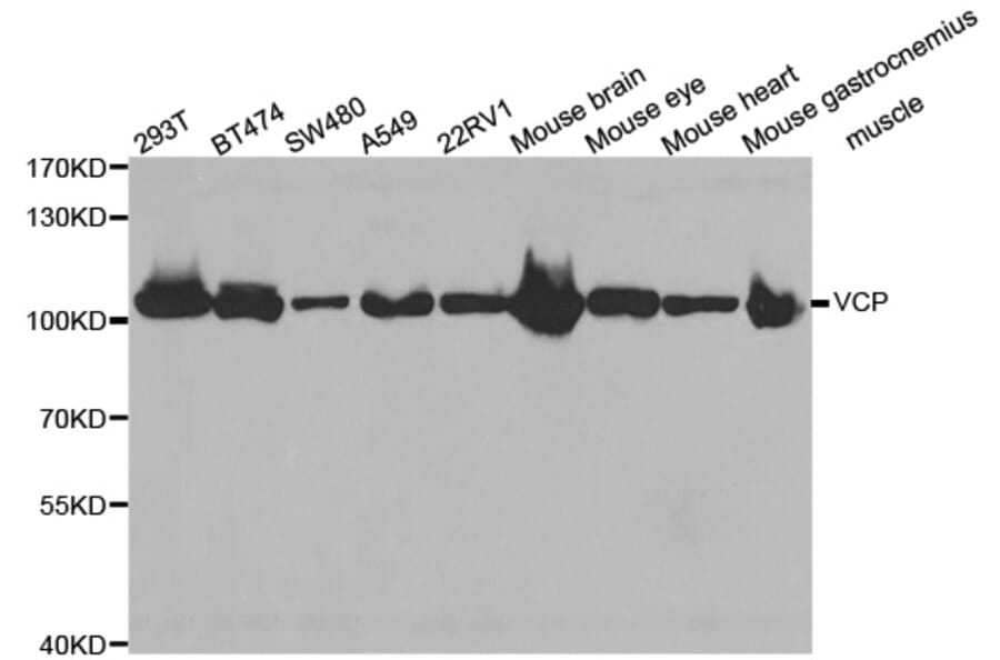 Western blot - VCP antibody from Signalway Antibody (38469) - Antibodies.com