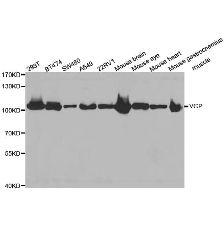 Western blot - VCP antibody from Signalway Antibody (38469) - Antibodies.com