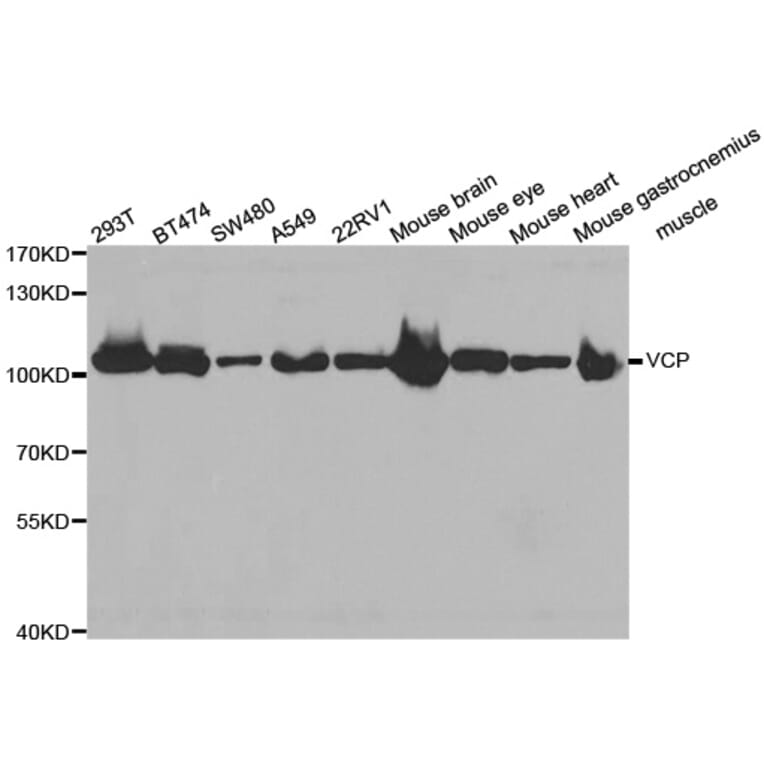 Western blot - VCP antibody from Signalway Antibody (38469) - Antibodies.com