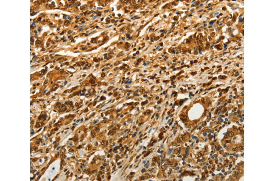 Immunohistochemistry - VCP antibody from Signalway Antibody (38469) - Antibodies.com