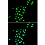 Immunofluorescence - VCP antibody from Signalway Antibody (38469) - Antibodies.com