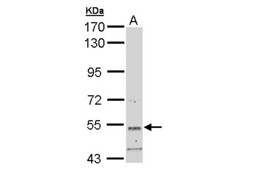 basic beta 2 syntrophin antibody from Signalway Antibody (22299) - Antibodies.com