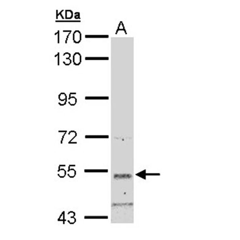 basic beta 2 syntrophin antibody from Signalway Antibody (22299) - Antibodies.com