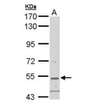 basic beta 2 syntrophin antibody from Signalway Antibody (22299) - Antibodies.com
