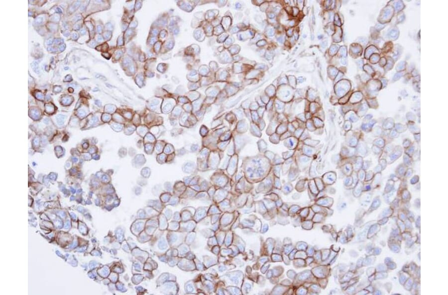 Immunohistochemistry - basic beta 2 syntrophin antibody from Signalway Antibody (22299) - Antibodies.com