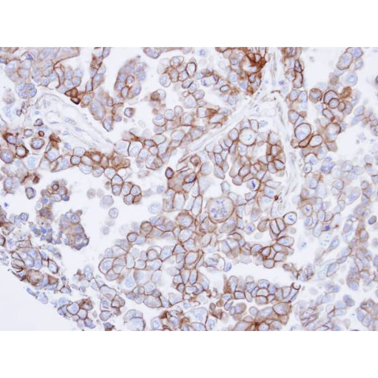 Immunohistochemistry - basic beta 2 syntrophin antibody from Signalway Antibody (22299) - Antibodies.com