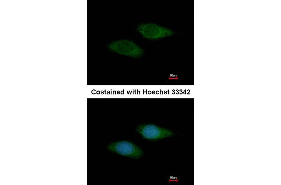 Immunofluorescence - basic beta 2 syntrophin antibody from Signalway Antibody (22299) - Antibodies.com