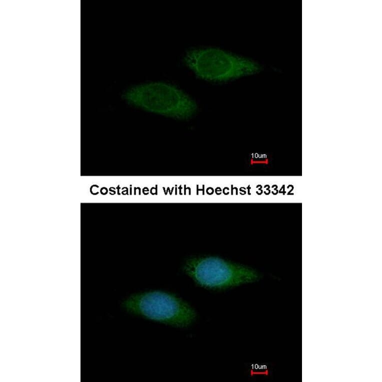 Immunofluorescence - basic beta 2 syntrophin antibody from Signalway Antibody (22299) - Antibodies.com