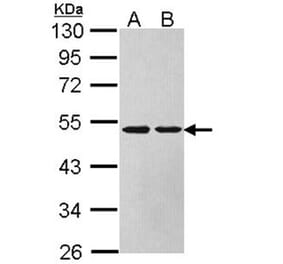 Argininosuccinate Lyase antibody from Signalway Antibody (22612) - Antibodies.com
