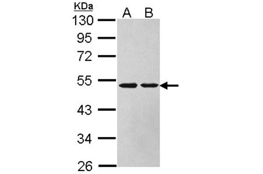 Argininosuccinate Lyase antibody from Signalway Antibody (22612) - Antibodies.com