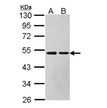 Argininosuccinate Lyase antibody from Signalway Antibody (22612) - Antibodies.com