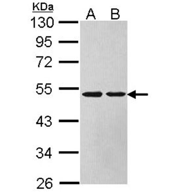 Argininosuccinate Lyase antibody from Signalway Antibody (22612) - Antibodies.com