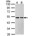 Argininosuccinate Lyase antibody from Signalway Antibody (22612) - Antibodies.com