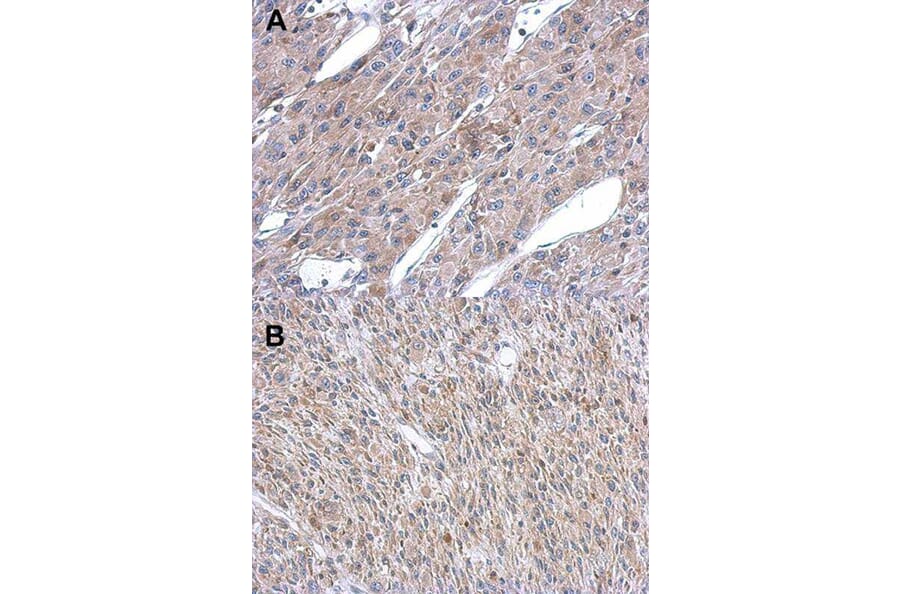 Immunohistochemistry - Argininosuccinate Lyase antibody from Signalway Antibody (22612) - Antibodies.com
