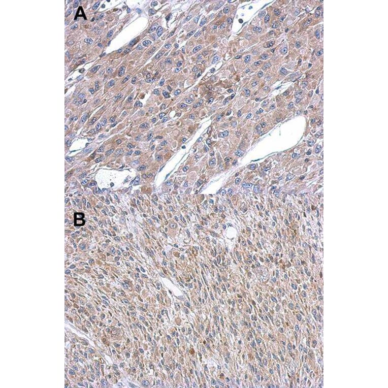 Immunohistochemistry - Argininosuccinate Lyase antibody from Signalway Antibody (22612) - Antibodies.com