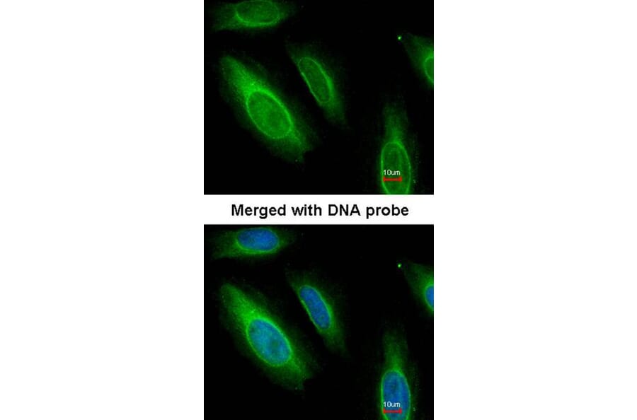 Immunofluorescence - Argininosuccinate Lyase antibody from Signalway Antibody (22612) - Antibodies.com
