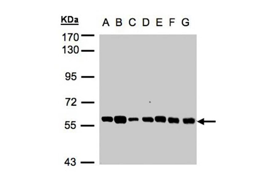 Tubby-related protein 1 antibody from Signalway Antibody (22789) - Antibodies.com