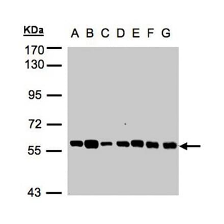 Tubby-related protein 1 antibody from Signalway Antibody (22789) - Antibodies.com