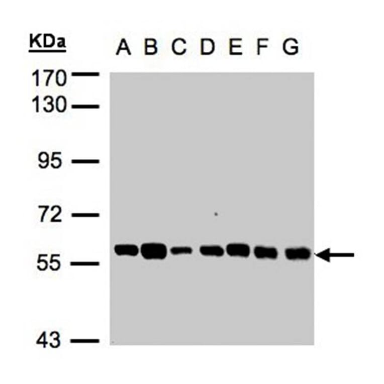 Tubby-related protein 1 antibody from Signalway Antibody (22789) - Antibodies.com