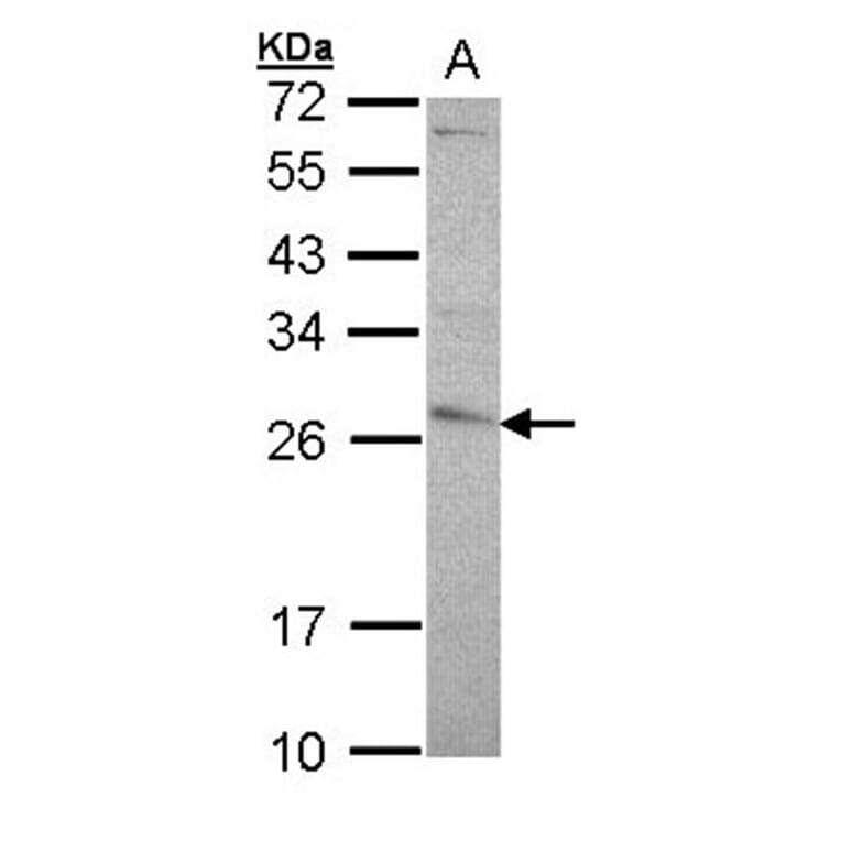 glutathione transferase antibody from Signalway Antibody (22923) - Antibodies.com
