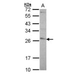 glutathione transferase antibody from Signalway Antibody (22923) - Antibodies.com