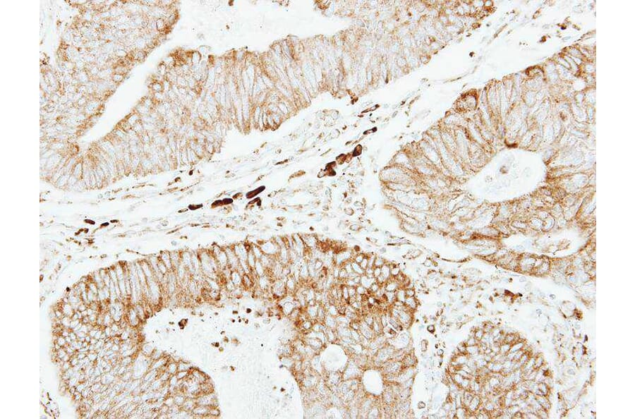 Immunohistochemistry - glutathione transferase antibody from Signalway Antibody (22923) - Antibodies.com