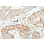 Immunohistochemistry - glutathione transferase antibody from Signalway Antibody (22923) - Antibodies.com