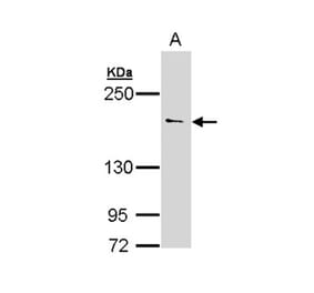 UNC13 (C. elegans)-like antibody from Signalway Antibody (23107) - Antibodies.com