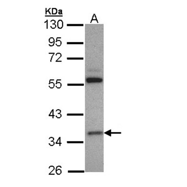 HL antibody from Signalway Antibody (22794) - Antibodies.com