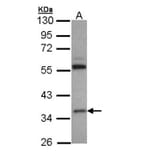 HL antibody from Signalway Antibody (22794) - Antibodies.com