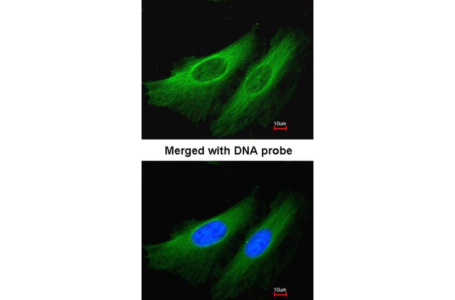 Immunofluorescence - HL antibody from Signalway Antibody (22794) - Antibodies.com