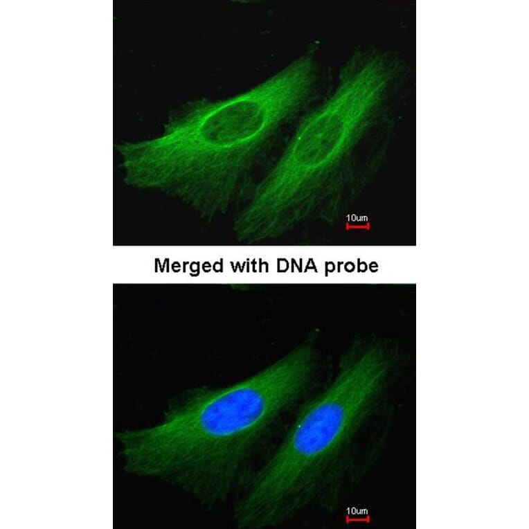 Immunofluorescence - HL antibody from Signalway Antibody (22794) - Antibodies.com