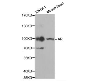 Western blot - AR Antibody from Signalway Antibody (32572) - Antibodies.com