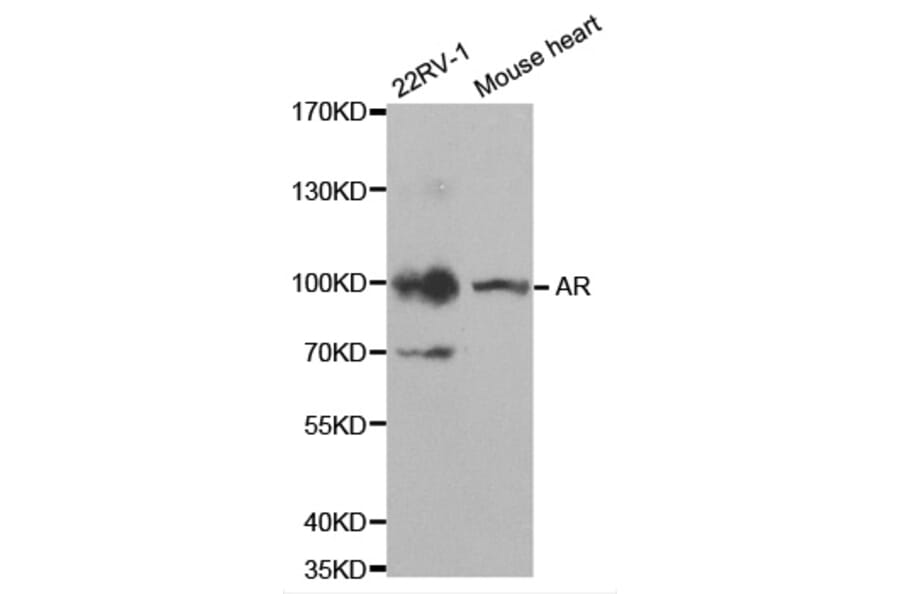 Western blot - AR Antibody from Signalway Antibody (32572) - Antibodies.com