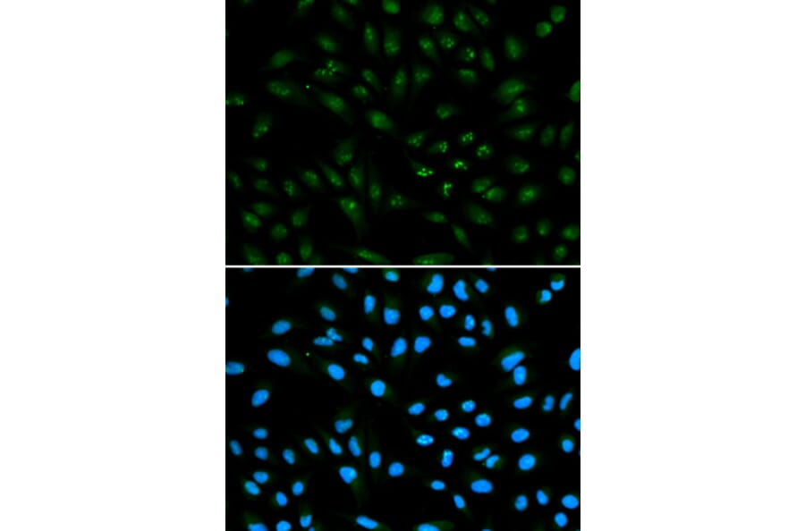 Immunofluorescence - AR Antibody from Signalway Antibody (32572) - Antibodies.com