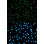 Immunofluorescence - AR Antibody from Signalway Antibody (32572) - Antibodies.com