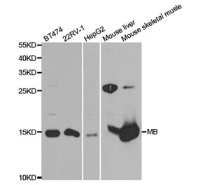 Western blot - MB Antibody from Signalway Antibody (32870) - Antibodies.com