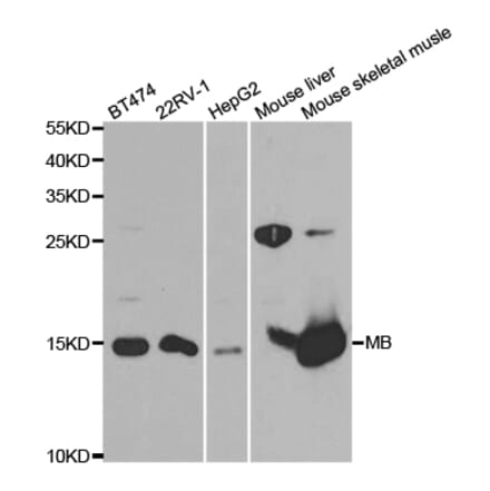 Western blot - MB Antibody from Signalway Antibody (32870) - Antibodies.com