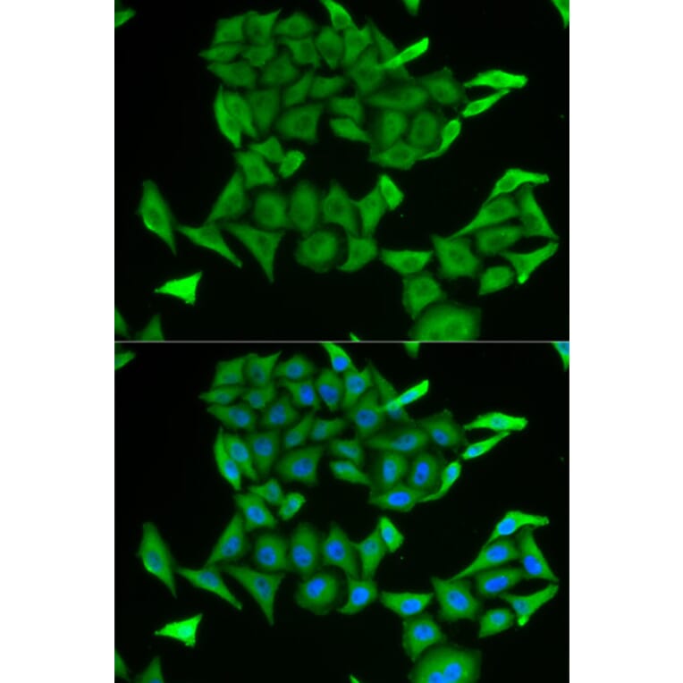 Immunofluorescence - MB Antibody from Signalway Antibody (32870) - Antibodies.com