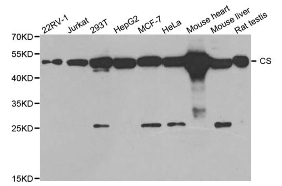 Western blot - CS Antibody from Signalway Antibody (32989) - Antibodies.com