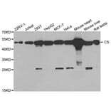 Western blot - CS Antibody from Signalway Antibody (32989) - Antibodies.com