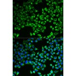 Immunofluorescence - CS Antibody from Signalway Antibody (32989) - Antibodies.com
