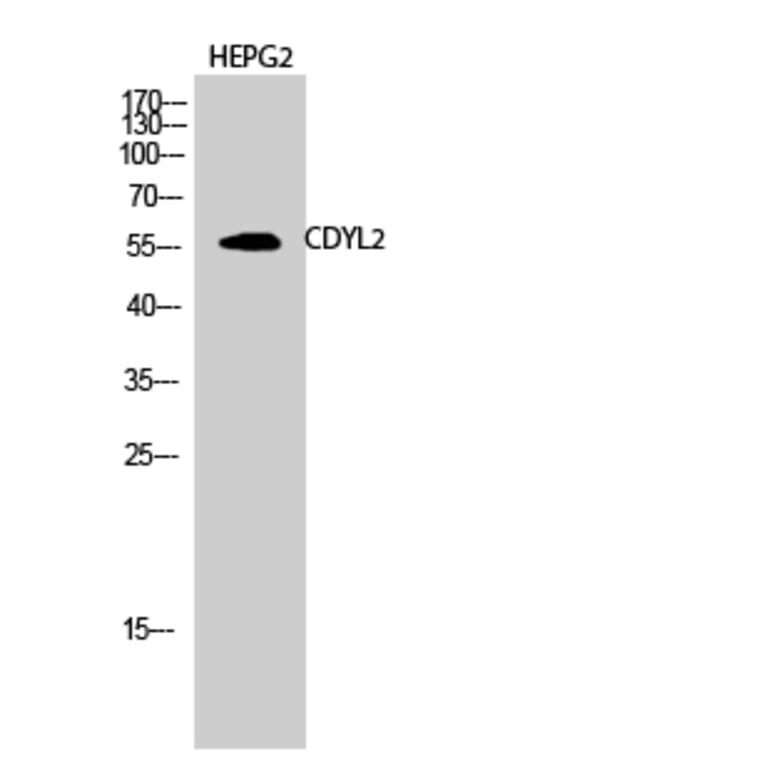 Western blot - CDYL2 Polyclonal Antibody from Signalway Antibody (40726) - Antibodies.com