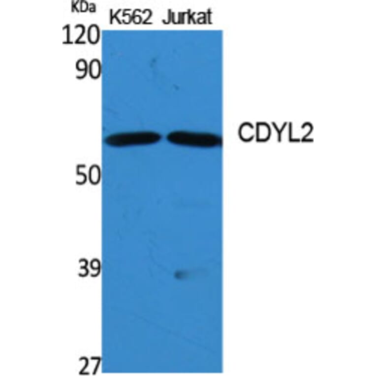 Western blot - CDYL2 Polyclonal Antibody from Signalway Antibody (40726) - Antibodies.com