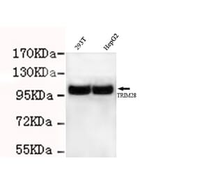 TRIM28 Monoclonal Antibody from Signalway Antibody (27026) - Antibodies.com