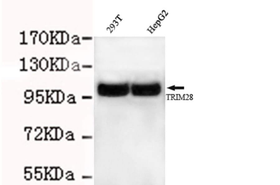 TRIM28 Monoclonal Antibody from Signalway Antibody (27026) - Antibodies.com